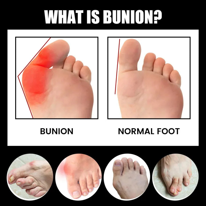 Orthopedic Bunion Relief Socks (Buy 1 Get 1 FREE)