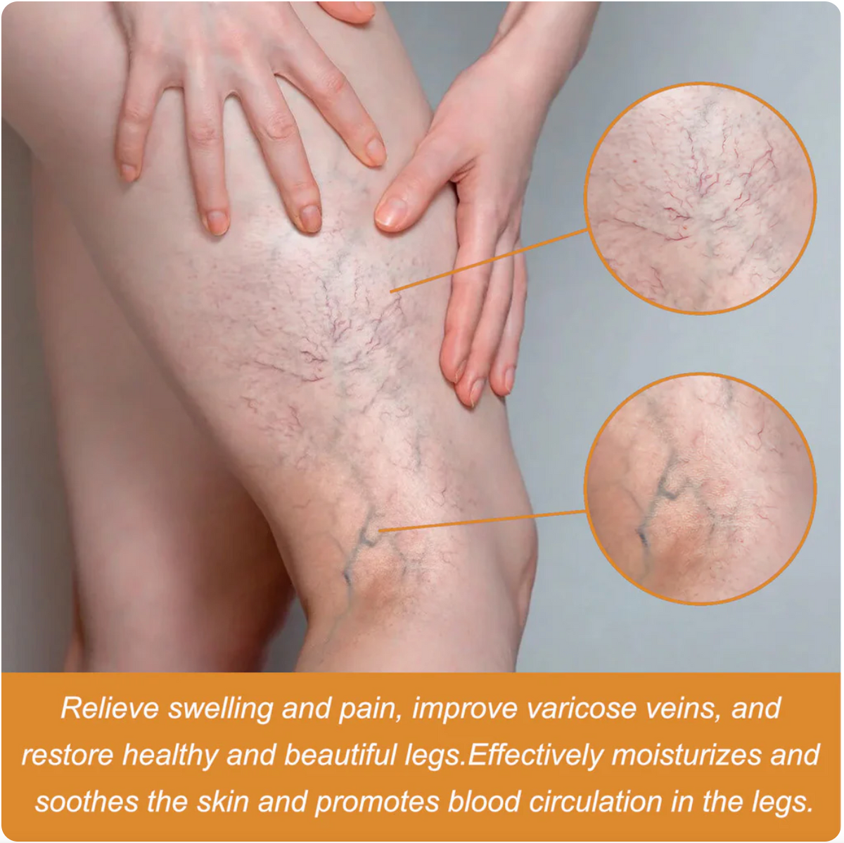 Varicose Veins Relief Herbal Spray - (Buy 1 Get 1 FREE🔥🔥)