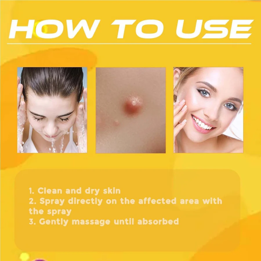 Original Bee Venom Wart & Skin Tag Remover Spray -(Buy 1 Get 1 FREE🔥🔥)